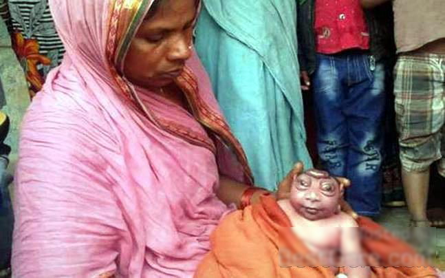【閲覧注意】インドで生まれた赤ちゃん、マジで人類じゃない・・・(画像)・1枚目