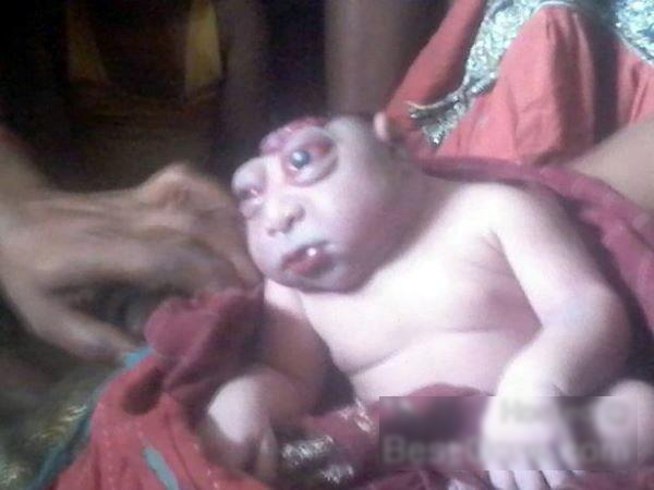 【閲覧注意】インドで生まれた赤ちゃん、マジで人類じゃない・・・(画像)・3枚目