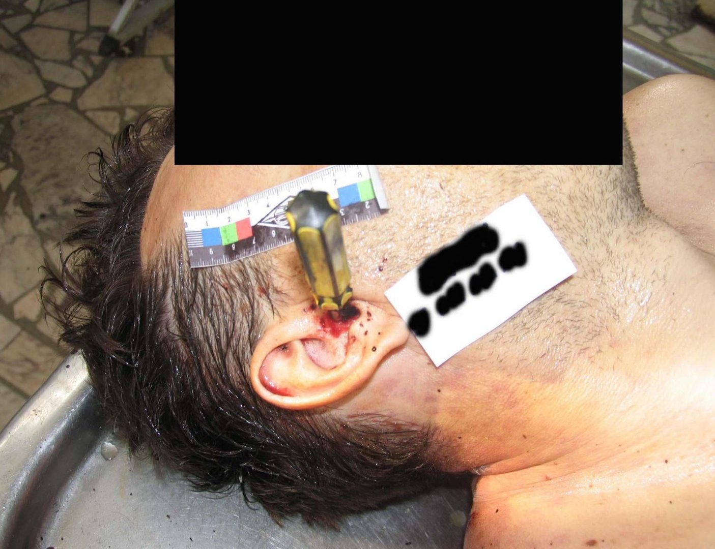 【超閲覧注意】ドライバーを耳に刺された男性が顔を開けられる・・・・・・(画像)・1枚目
