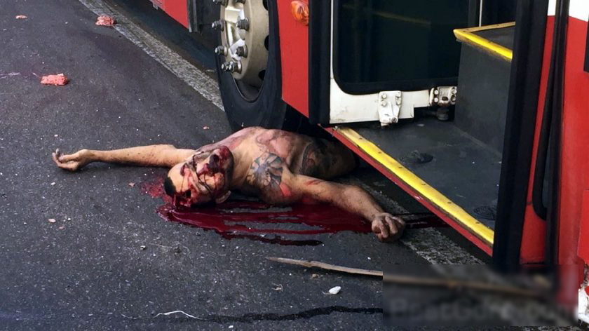 【閲覧注意】大型バスに轢かれた人間の体がコレ。(画像)・5枚目