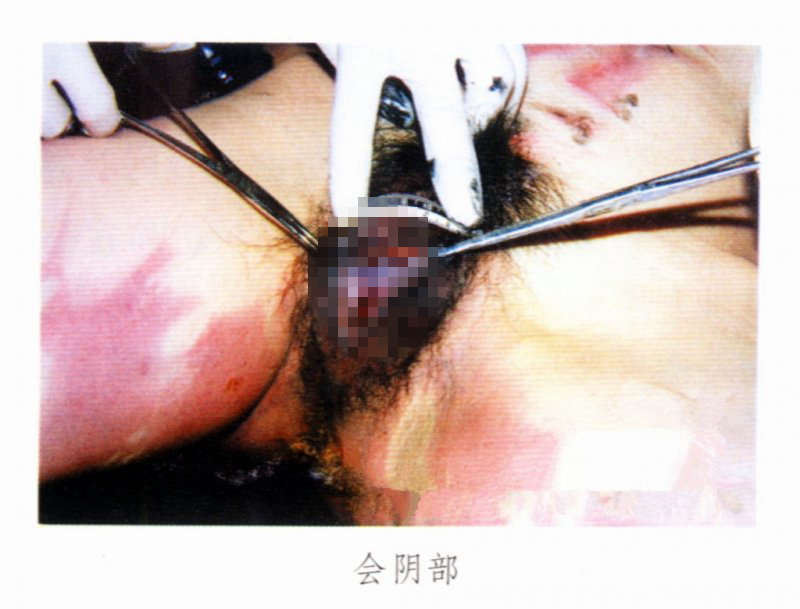 【閲覧注意】レイプされ全裸で縛られ遺体で発見された女性。(画像)・2枚目