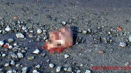【閲覧注意】ロシアで交通事故に遭った男性、勢い強すぎて顔がモゲる・・・・・(画像)・6枚目