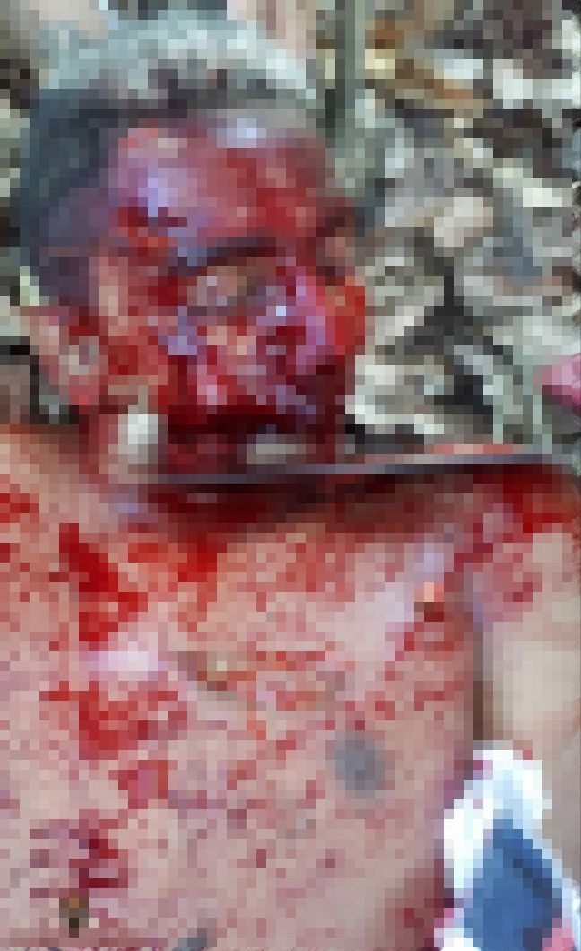 【閲覧注意】誤って赤ちゃんを撃ってしまったブラジルギャングの男、グループから追放されバラバラに処刑される・・・・・(画像)・1枚目