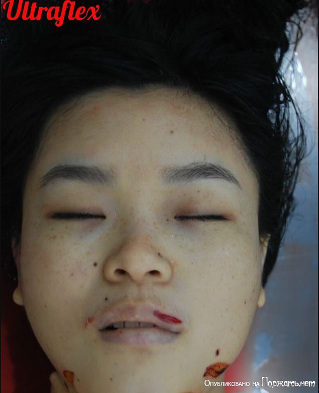 【グロ注意】中国でレイプ後メッタ刺しにされた20歳看護師女性、司法解剖の様子がヤバい！！(画像)・2枚目