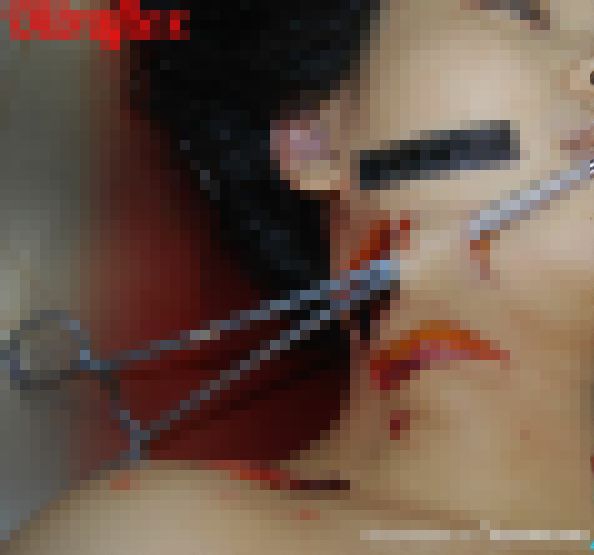 【グロ注意】中国でレイプ後メッタ刺しにされた20歳看護師女性、司法解剖の様子がヤバい！！(画像)・11枚目