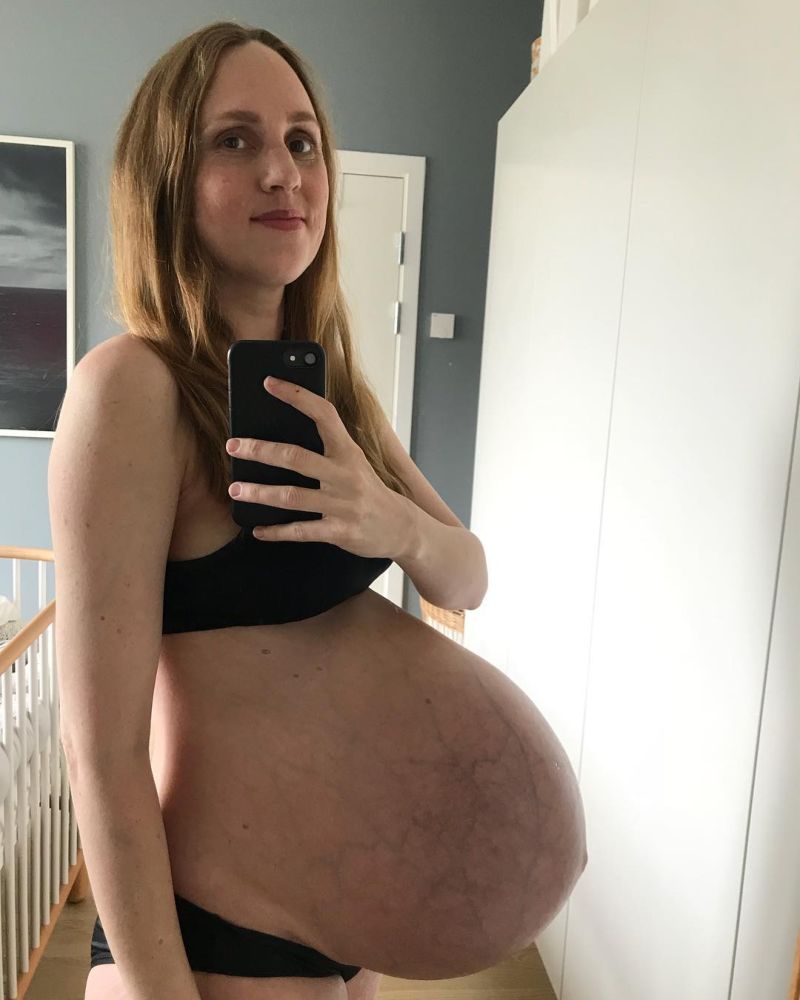 【破裂寸前】三つ子を妊娠したノルウェーの34歳女性、お腹が今にも破裂しそう・・・・・(画像)・4枚目