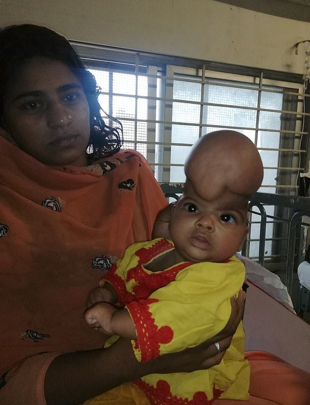 【衝撃】パキスタンで生まれた頭蓋骨の外側に脳を持つ少女、これかなり危ないだろ・・・・・(画像)・1枚目