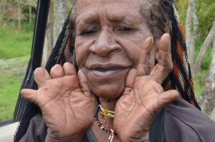 【衝撃】葬儀のあと女性が自分の指を切り落とすというパプアニューギニアのダニ族、指無くなるだろ・・・・(画像)・11枚目