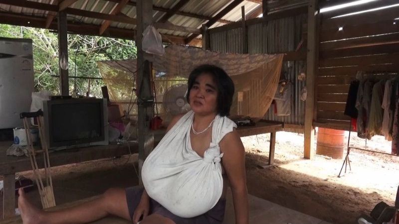 【巨乳症おばさん】タイで発見された巨乳症のおばさん御年46歳、せめてあと20年若ければ・・・・・(画像)・3枚目