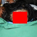 【恐怖】回転中の機械に長い髪が巻き込まれたインド人女性、頭皮ごと引き剥がされる！！(画像)