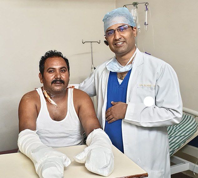 【リアルBJ】路上喧嘩で左手をほぼ切り落とされたインド人男性、凄腕外科医に完璧に修復される！！(画像)・1枚目