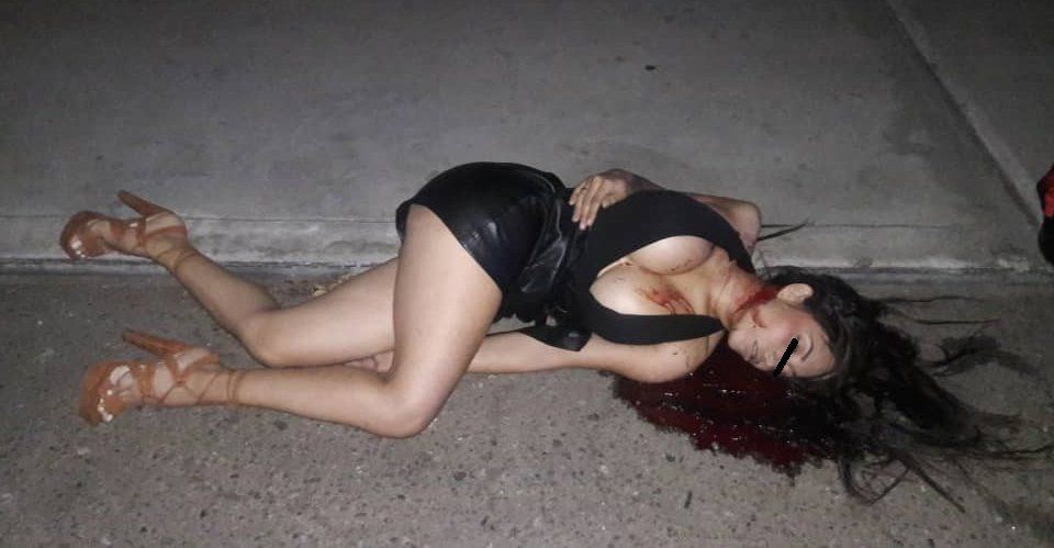 【爆乳遺体】コロンビアの爆乳美人モデルさん、射殺され検死の様子が全世界に公開される・・・・（画像）・8枚目